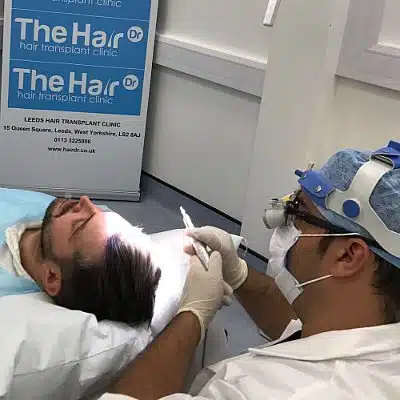 FUE Transplant Surgery examples