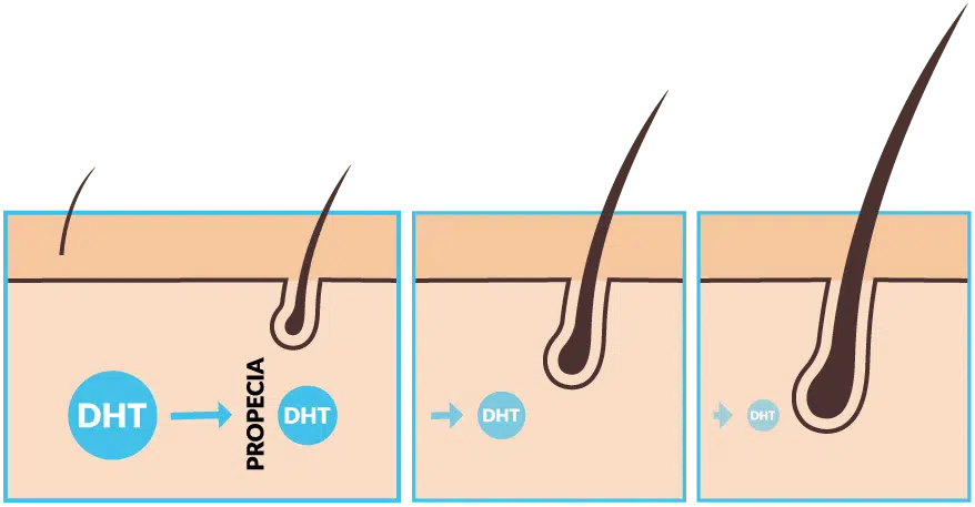 DHT hair growth cycle
