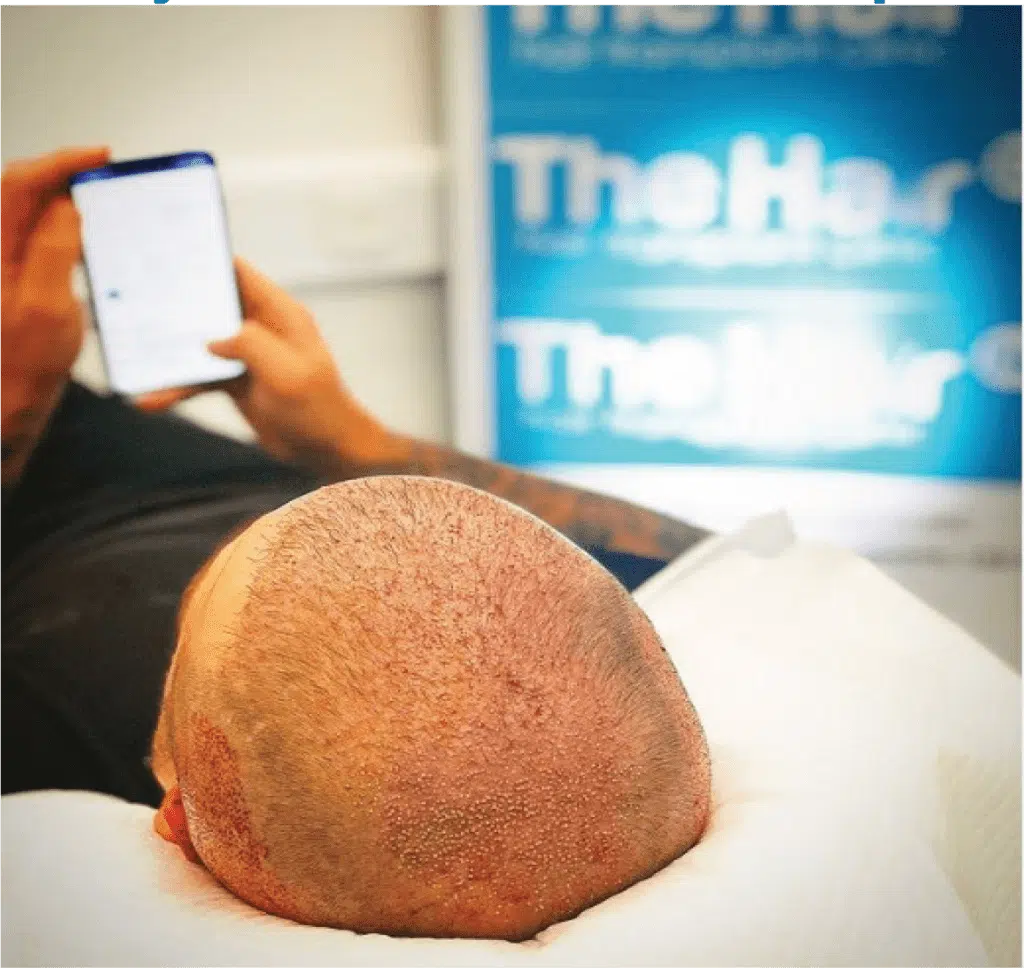 maintain a clean scalp after transplant